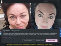 Thermage BRNO - DVOJITÉ Omlazení bez skalpelu